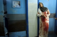 زن فلسطینی با لباسی که به خون یکی از بستگانش آغشته شده است در بیمارستانی در غزه در جریان جنگ ۵۱روزه. منبع:‌ آتلانتیک